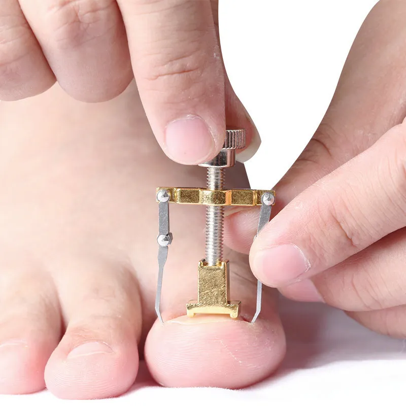 CORRECTOR DE UÑAS ENCARNADAS